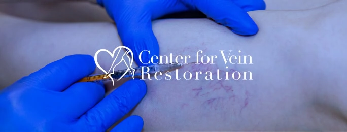 A doctor treats varicose veins with injection for a digital marketing agency’s SEO services page.